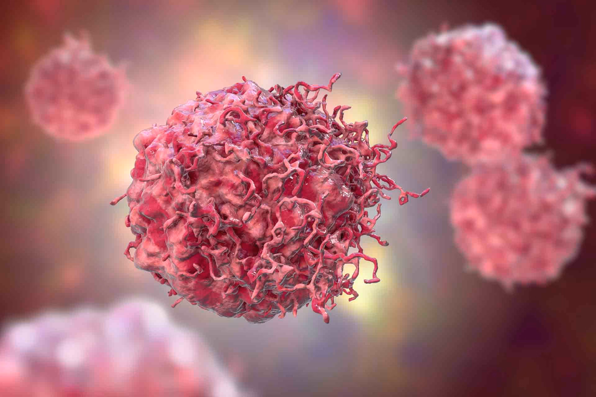 lung cancer and mesothelioma, asbestos lung cancer, mesothelioma vs lung cancer, asbestos-related diseases, asbestos exposure symptoms, lung cancer asbestos claims