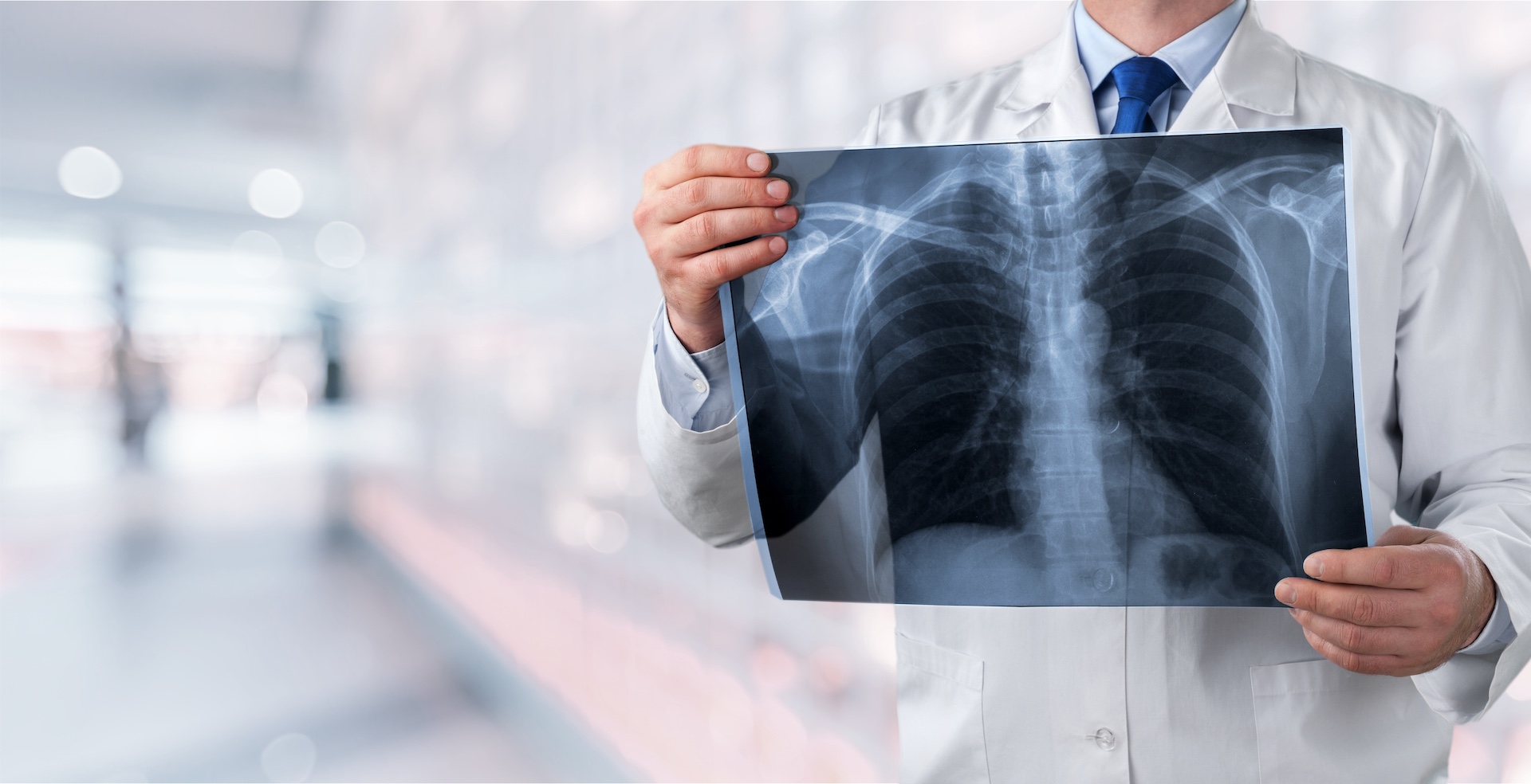 Lung cancer personal injury attorney