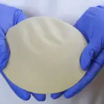 Allergan Breast Implants Lawsuits